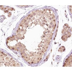 Invitrogen Phospho-B-Raf (Thr599) Polyclonal Antibody 100 &mu;L; Unconjugated:Antibodies,