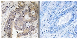 Invitrogen Phospho-CAD (Thr456) Polyclonal Antibody 100 &mu;L; Unconjugated:Antibodies,
