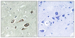Invitrogen Phospho-Calmodulin (Thr79, Ser81) Polyclonal Antibody 100 &mu;L;