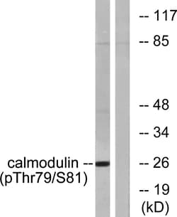 Invitrogen Phospho-Calmodulin (Thr79, Ser81) Polyclonal Antibody 100 &mu;L | Buy Online | Invitrogen&trade; | Fisher Scientific