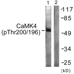Invitrogen Phospho-CaMKIV (Thr196, Thr200) Polyclonal Antibody 100 &mu;L | Buy Online | Invitrogen&trade; | Fisher Scientific
