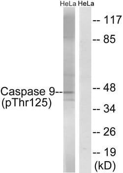 Invitrogen Phospho-Caspase 9 (Thr125) Polyclonal Antibody 100 &mu;L | Buy Online | Invitrogen&trade; | Fisher Scientific