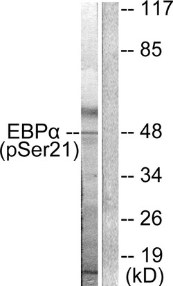 Invitrogen Phospho-C/EBP alpha (Ser21) Polyclonal Antibody 100 &mu;L | Buy Online | Invitrogen&trade; | Fisher Scientific