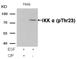 Invitrogen Phospho-IKK alpha (Thr23) Polyclonal Antibody 100 &mu;L; Unconjugated:Antibodies,