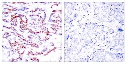 Invitrogen Phospho-ATF2 (Ser94, Ser112) Polyclonal Antibody 100 &mu;L;