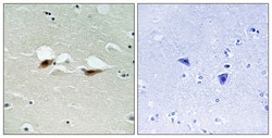 Invitrogen Phospho-ATF2 (Ser472) Polyclonal Antibody 100 &mu;L | Buy Online | Invitrogen&trade; | Fisher Scientific