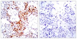 Invitrogen Phospho-ATF2 (Thr51, Thr69) Polyclonal Antibody 100 &mu;L; Unconjugated:Antibodies,