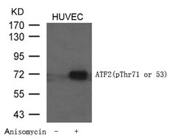 Invitrogen Phospho-ATF2 (Thr53, Thr71) Polyclonal Antibody 100 &mu;L | Buy Online | Invitrogen&trade; | Fisher Scientific