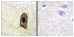 Invitrogen Phospho-CSF1R (Tyr561) Polyclonal Antibody 100 &mu;L; Unconjugated:Antibodies,
