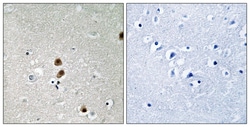 Invitrogen Phospho-CtBP1 (Ser422) Polyclonal Antibody 100 &mu;L; Unconjugated:Antibodies,