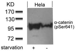 Invitrogen Phospho-alpha Catenin (Ser641) Polyclonal Antibody 100 &mu;L | Buy Online | Invitrogen&trade; | Fisher Scientific