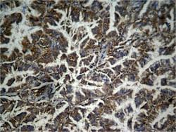 Phospho-beta Catenin (Tyr333) Polyclonal Antibody, Invitrogen 100 &mu;L;