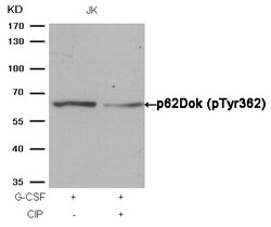 Invitrogen Phospho-DOK1 (Tyr362) Polyclonal Antibody 100 &mu;L | Buy Online | Invitrogen&trade; | Fisher Scientific