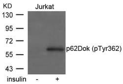 Invitrogen Phospho-DOK1 (Tyr362) Polyclonal Antibody 100 &mu;L | Buy Online | Invitrogen&trade; | Fisher Scientific