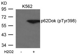 Invitrogen Phospho-DOK1 (Tyr398) Polyclonal Antibody 100 &mu;L | Buy Online | Invitrogen&trade; | Fisher Scientific