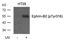 Invitrogen Phospho-Ephrin B2 (Tyr316) Polyclonal Antibody 100 &mu;L | Buy Online | Invitrogen&trade; | Fisher Scientific