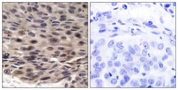 Phospho-4EBP1 (Thr37) Polyclonal Antibody:Antibodies, Polyclonal