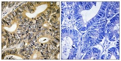Invitrogen Phospho-4EBP1 (Thr70) Polyclonal Antibody 100 &mu;L; Unconjugated:Antibodies,