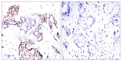 Invitrogen Phospho-ELK1 (Ser389) Polyclonal Antibody 100 μL; Unconjugated:Antibodies,