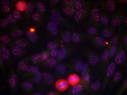 Phospho-ELK1 (Thr417) Polyclonal Antibody, Invitrogen 100 &mu;L; Unconjugated:Antibodies,