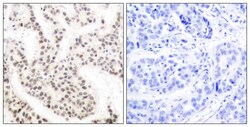 Phospho-ELK1 (Thr417) Polyclonal Antibody, Invitrogen 100 &mu;L; Unconjugated:Antibodies,