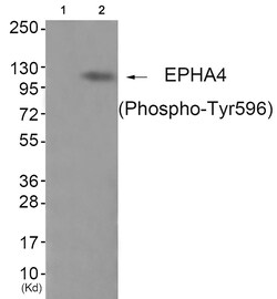 Invitrogen Phospho-EphA4 (Tyr596) Polyclonal Antibody 100 &mu;L; Unconjugated:Antibodies,