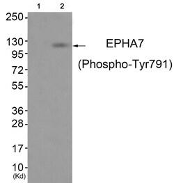 Invitrogen Phospho-EphA7 (Tyr791) Polyclonal Antibody 100 &mu;L; Unconjugated:Antibodies,