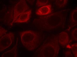 Phospho-ErbB3 (Tyr1328) Polyclonal Antibody:Antibodies, Polyclonal