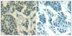 Phospho-ErbB3 (Tyr1328) Polyclonal Antibody:Antibodies, Polyclonal