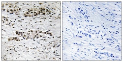 Invitrogen Phospho-Estrogen Receptor alpha (Ser102) Polyclonal Antibody