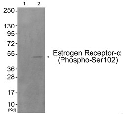 Invitrogen Phospho-Estrogen Receptor alpha (Ser102) Polyclonal Antibody 100 &mu;L | Buy Online | Invitrogen&trade; | Fisher Scientific