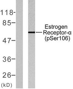 Invitrogen Phospho-Estrogen Receptor alpha (Ser106) Polyclonal Antibody 100 &mu;L | Buy Online | Invitrogen&trade; | Fisher Scientific
