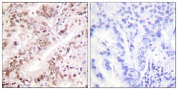 Phospho-Estrogen Receptor alpha (Tyr537) Polyclonal Antibody, Invitrogen