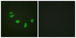 Invitrogen Phospho-ETS1 (Thr38) Polyclonal Antibody 100 &mu;L; Unconjugated:Antibodies,