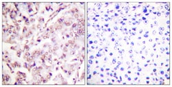 Invitrogen Phospho-ETS1 (Thr38) Polyclonal Antibody 100 &mu;L; Unconjugated:Antibodies,