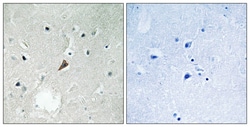 Invitrogen Phospho-PYK2 (Tyr579) Polyclonal Antibody 100 &mu;L; Unconjugated:Antibodies,