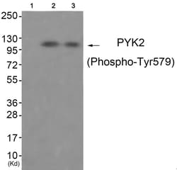 Invitrogen Phospho-PYK2 (Tyr579) Polyclonal Antibody 100 &mu;L | Buy Online | Invitrogen&trade; | Fisher Scientific