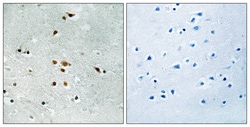 Invitrogen Phospho-FER (Tyr402) Polyclonal Antibody 100 &mu;L; Unconjugated:Antibodies,