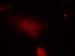 Phospho-FOXO1 (Ser319) Polyclonal Antibody, Invitrogen 100 &mu;L; Unconjugated:Antibodies,