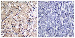 Phospho-FOXO1 (Ser319) Polyclonal Antibody, Invitrogen 100 &mu;L; Unconjugated:Antibodies,