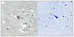 Invitrogen Phospho-VEGF Receptor 1 (Tyr1048) Polyclonal Antibody 100 &mu;L;