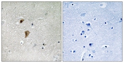 Invitrogen Phospho-HSF1 (Thr142) Polyclonal Antibody 100 &mu;L; Unconjugated:Antibodies,