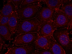 Invitrogen Phospho-IGF1R beta (Tyr1161) Polyclonal Antibody 100 &mu;L | Buy Online | Invitrogen&trade; | Fisher Scientific