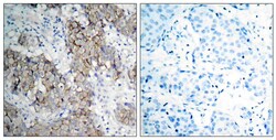 Invitrogen Phospho-IGF1R beta (Tyr1161) Polyclonal Antibody 100 &mu;L | Buy Online | Invitrogen&trade; | Fisher Scientific