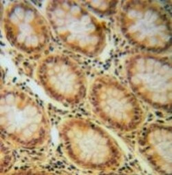 Invitrogen Phospho-IGF1R beta (Tyr1165, Tyr1166) Polyclonal Antibody 100