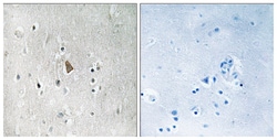 Invitrogen Phospho-IGF1R beta (Tyr1346) Polyclonal Antibody 100 &mu;L;