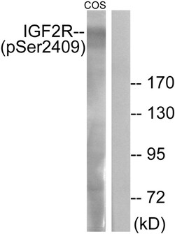Invitrogen Phospho-IGF2R (Ser2409) Polyclonal Antibody 100 &mu;L | Buy Online | Invitrogen&trade; | Fisher Scientific