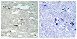 Invitrogen Phospho-ILK (Ser246) Polyclonal Antibody 100 &mu;L; Unconjugated:Antibodies,
