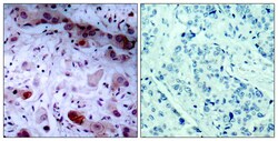 Invitrogen Phospho-JAK1 (Tyr1034) Polyclonal Antibody 100 &mu;L; Unconjugated:Antibodies,