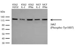 Invitrogen Phospho-JAK2 (Tyr1007) Polyclonal Antibody 100 &mu;L | Buy Online | Invitrogen&trade; | Fisher Scientific